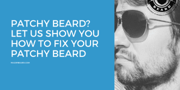Patchy Beard